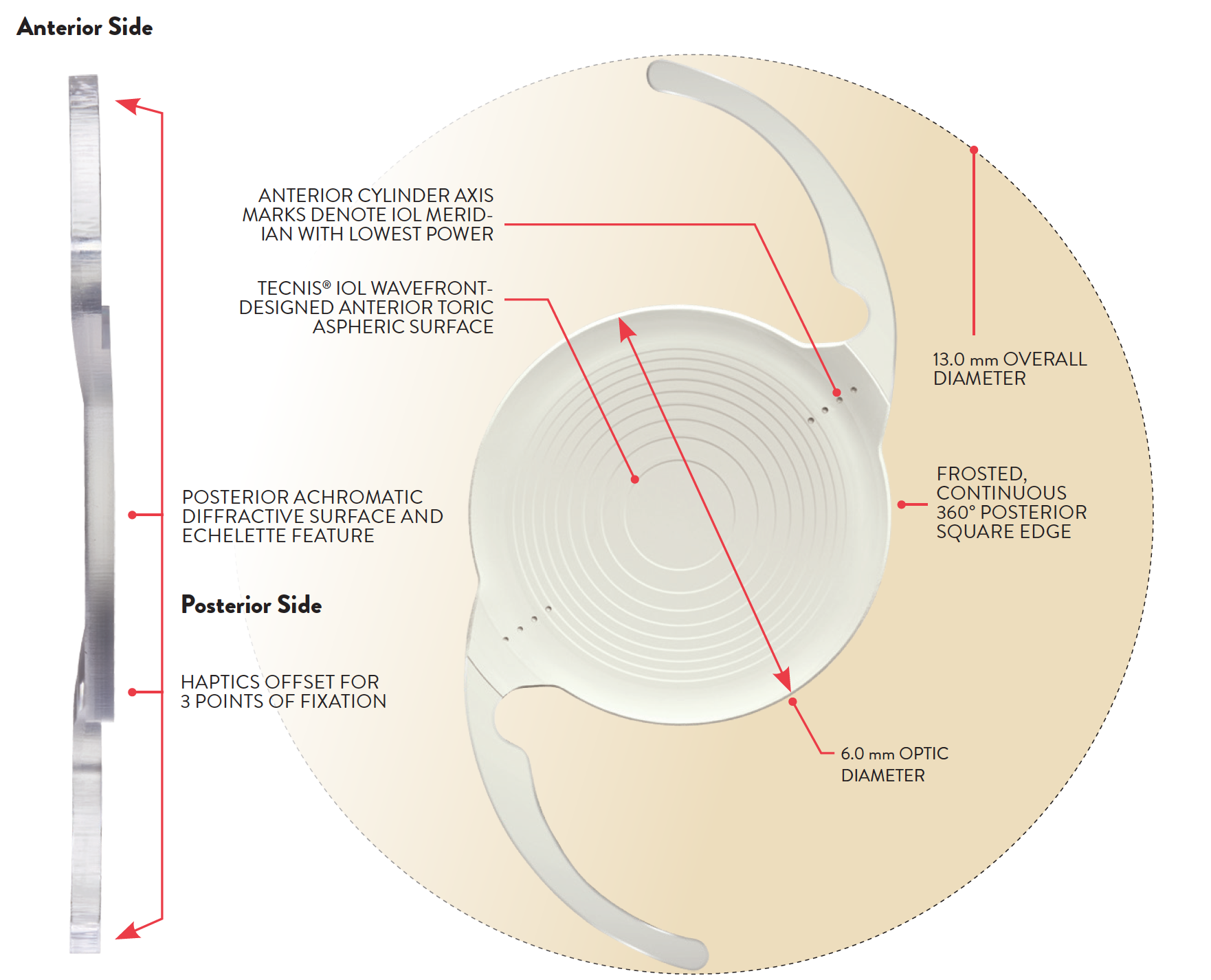 TECNIS Symfony® Extended Range of Vision IOL Abbott Medical